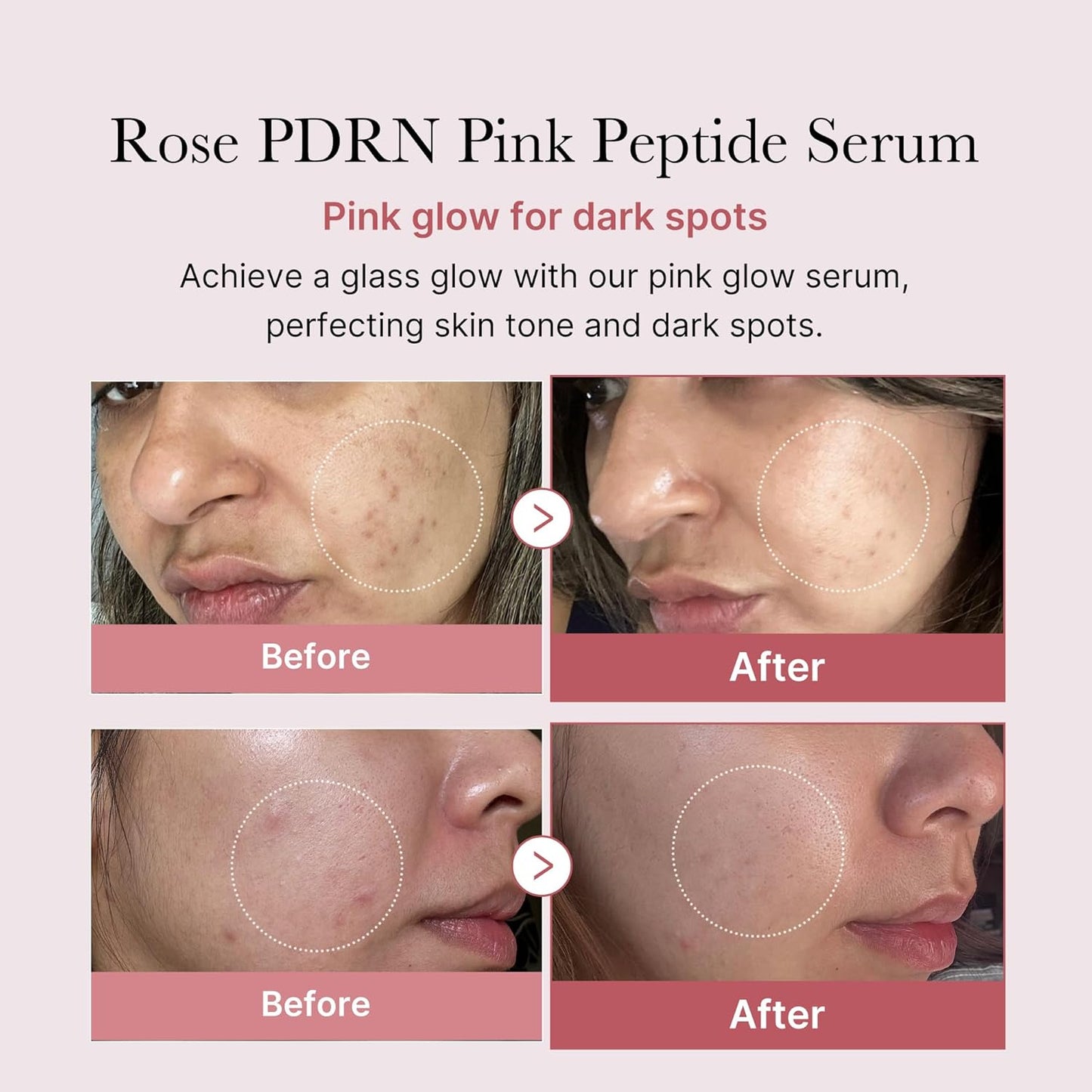Medicube PDRN Pink Peptide Serum – سيروم التوهّج الوردي مع البيبتيد والنياسيناميد