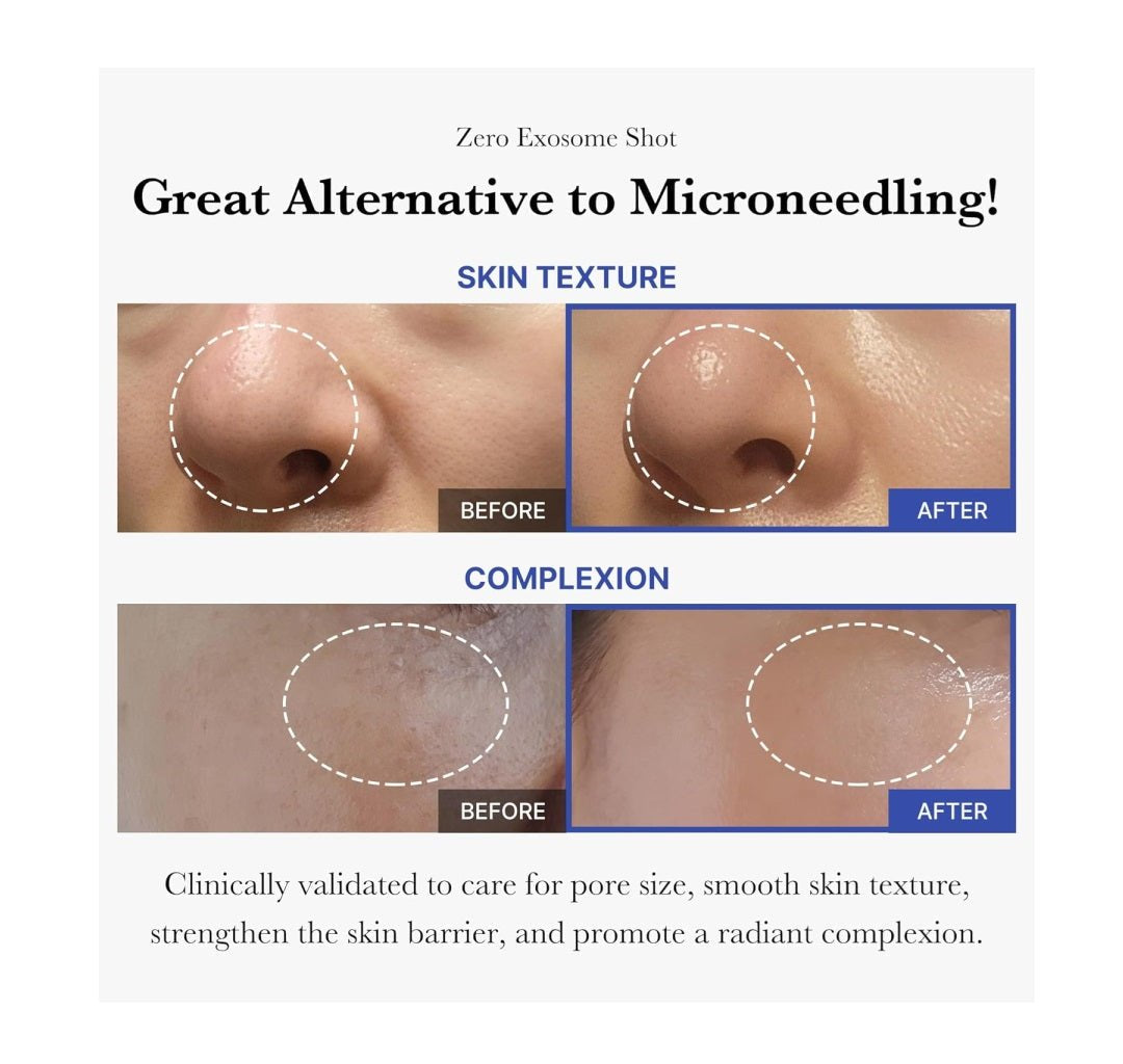 Medicube One Day Exosome Shot Pore Ampoule 2000 30ml أمبولة المسام من ميديكيوب وان داي إكسوسوم شوت 2000