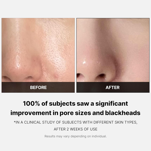 MEDICUBE ZERO PORE PAD 2.0 - 70PCS | ميدي كيوب وسائد تونر - ٧٠ قطعة