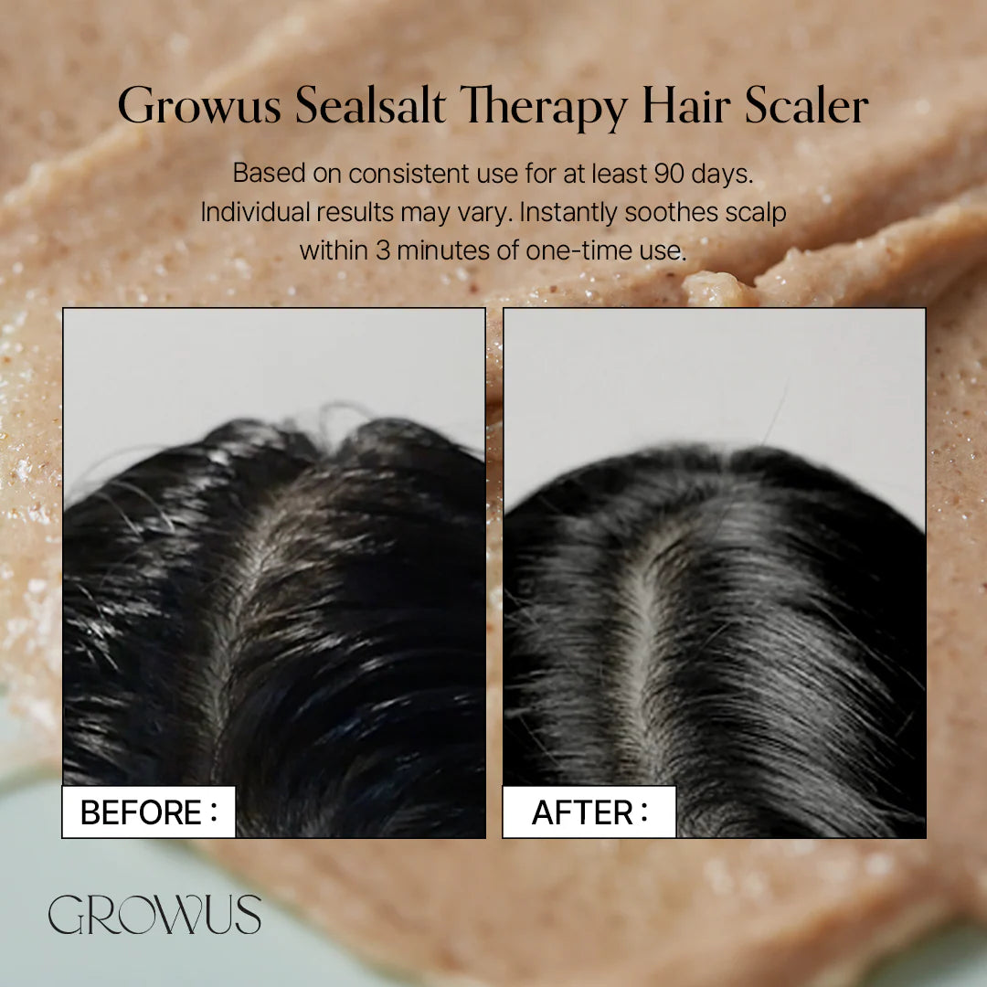 Growus Sea Salt Therapy Scalp Scaler