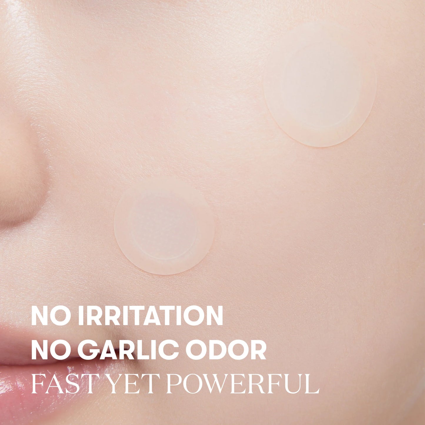 VT cosmetics Garlic AC Reedle shot Point Patch