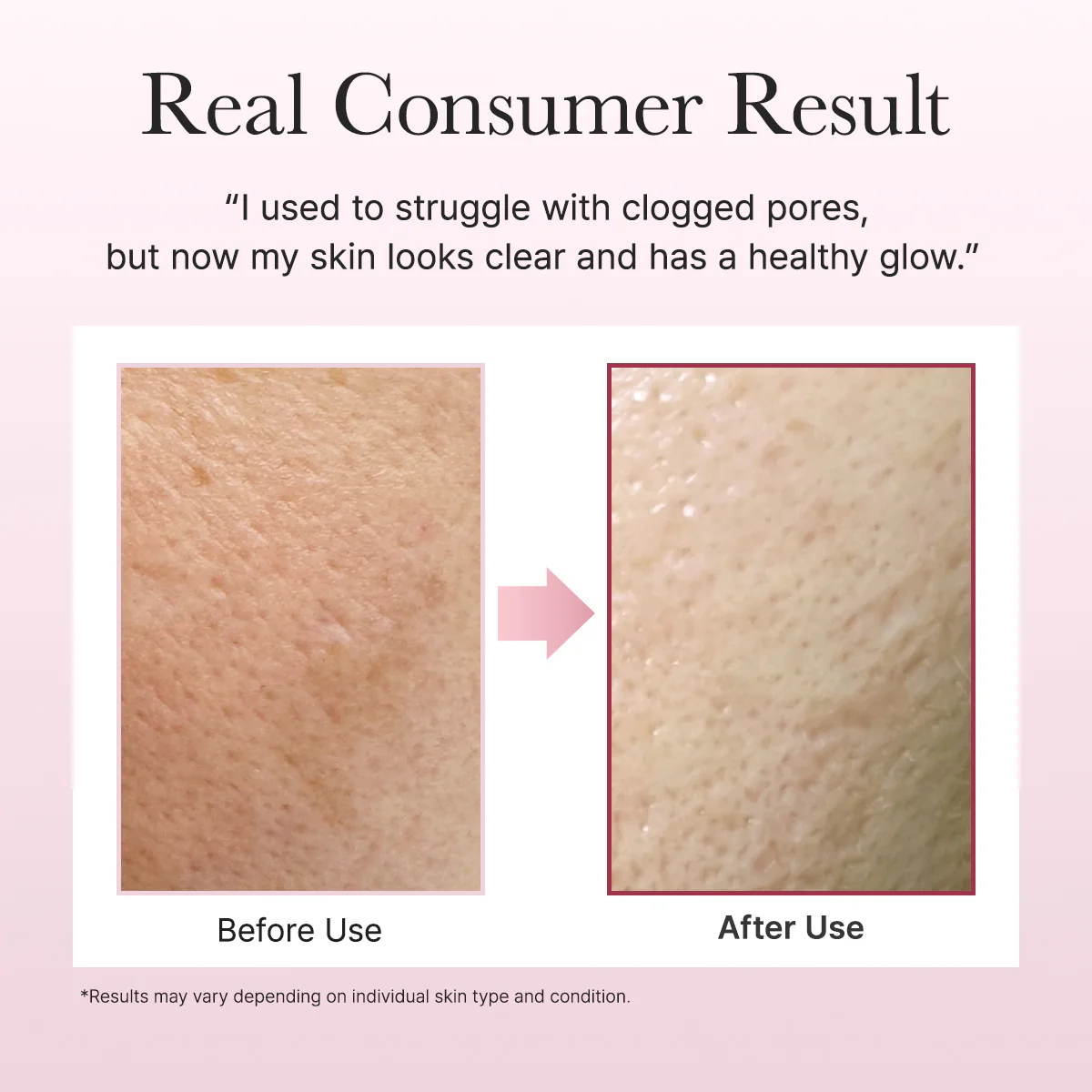 Arencia Fresh Rosehip Mochi Cleanser