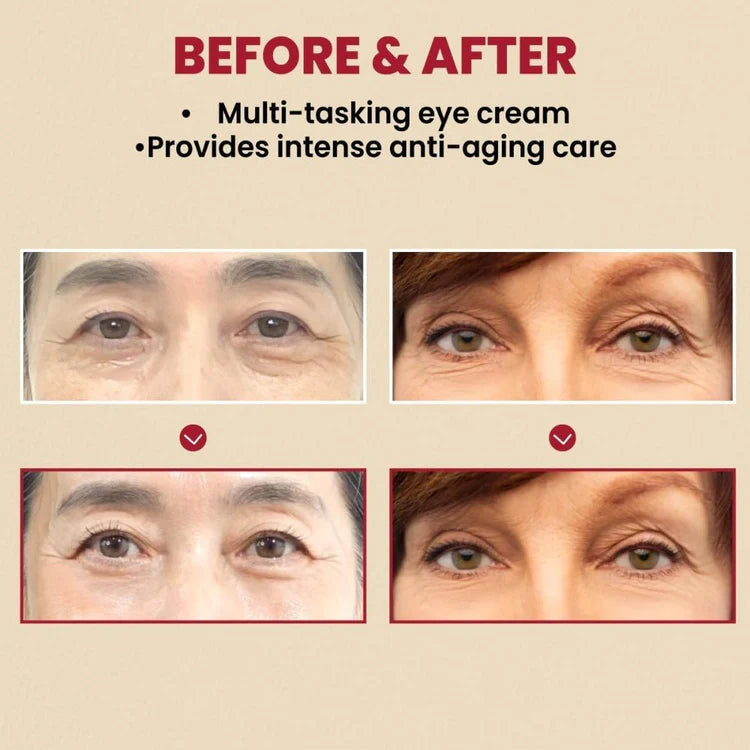 SEOUL 1988 Eye Cream : Retinal Liposome 4% + Fermented Bean