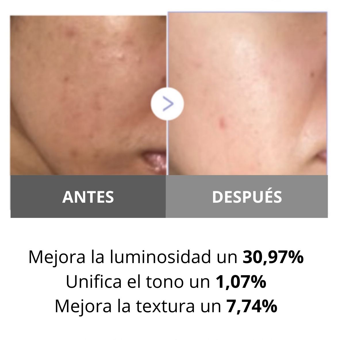 Medicube AGE-R BOOSTER PRO MINI White