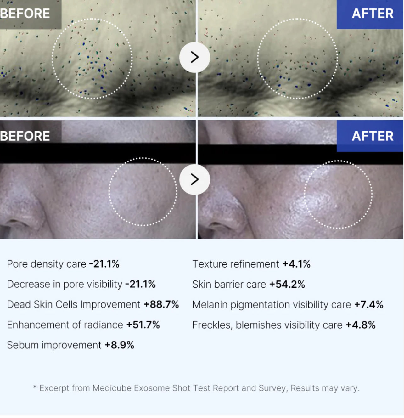 medicube One Day Exosome Shot Pore Ampoule 7500