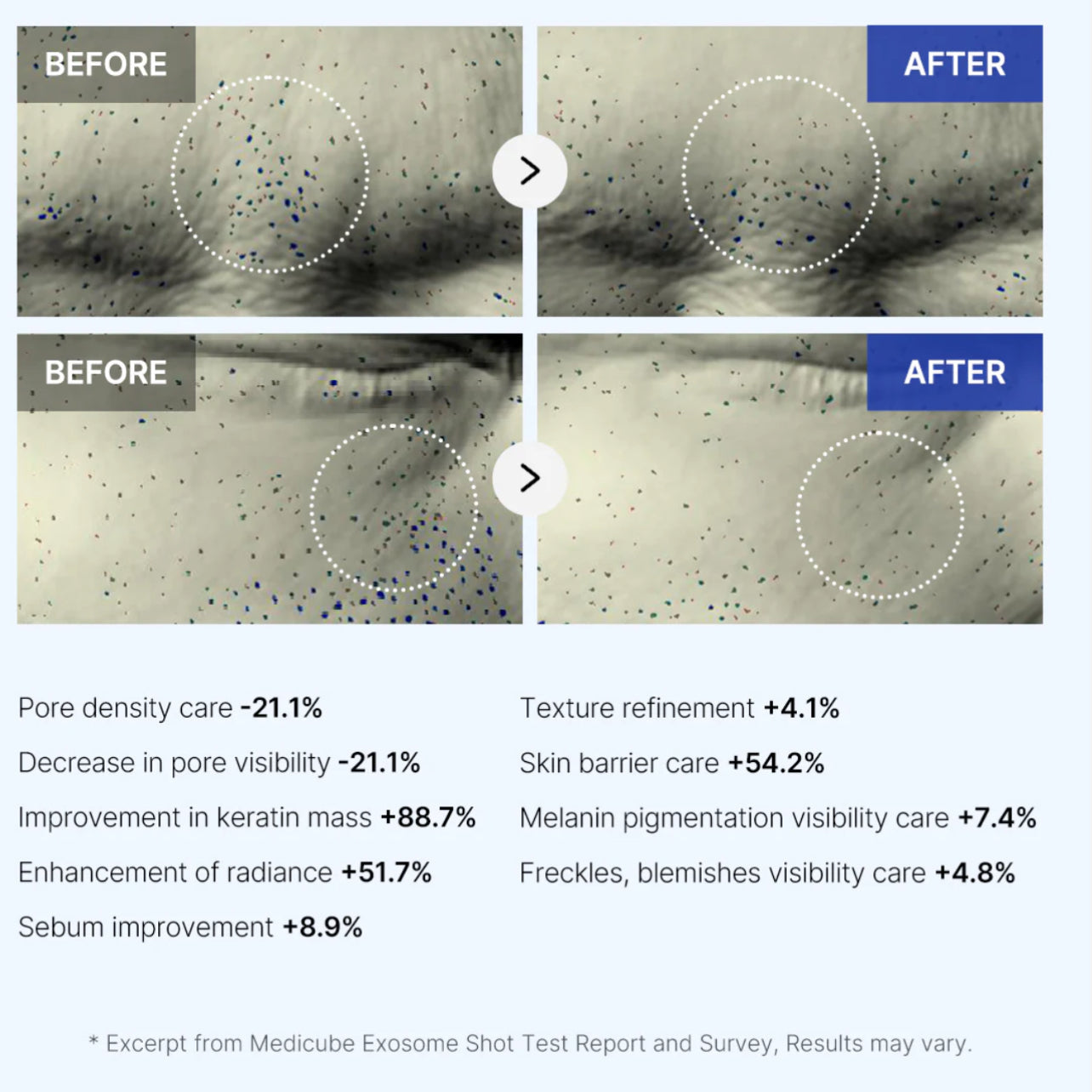 medicube One Day Exosome Shot Pore Ampoule 7500