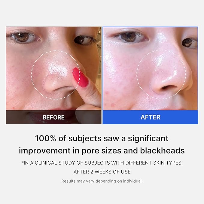 MEDICUBE ZERO PORE PAD 2.0 - 70PCS | ميدي كيوب وسائد تونر - ٧٠ قطعة