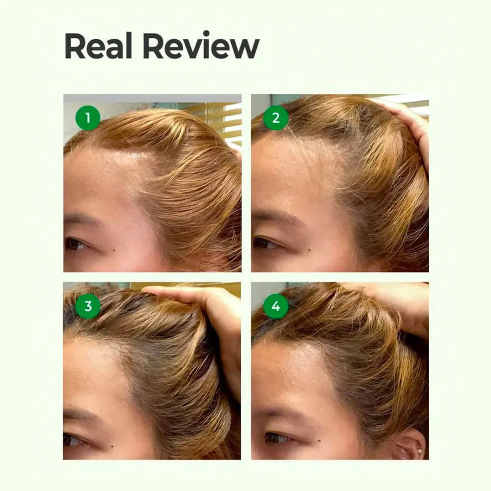 SOME BY MI CICA PEPTIDE ANTI HAIR LOSS DERMA SCALP SHAMPOO - 285 ML | سوم باي مي شامبو سيكا ضد تساقط الشعر - 285 مل