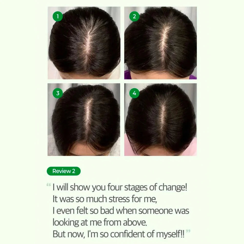 SOME BY MI CICA PEPTIDE ANTI HAIR LOSS DERMA SCALP SHAMPOO - 285 ML | سوم باي مي شامبو سيكا ضد تساقط الشعر - 285 مل